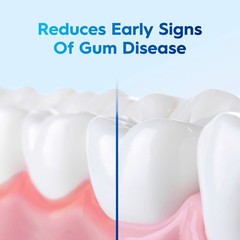Free Mouthwash for Gingivitis and Plaque, Smooth Mint Flavor Mouth